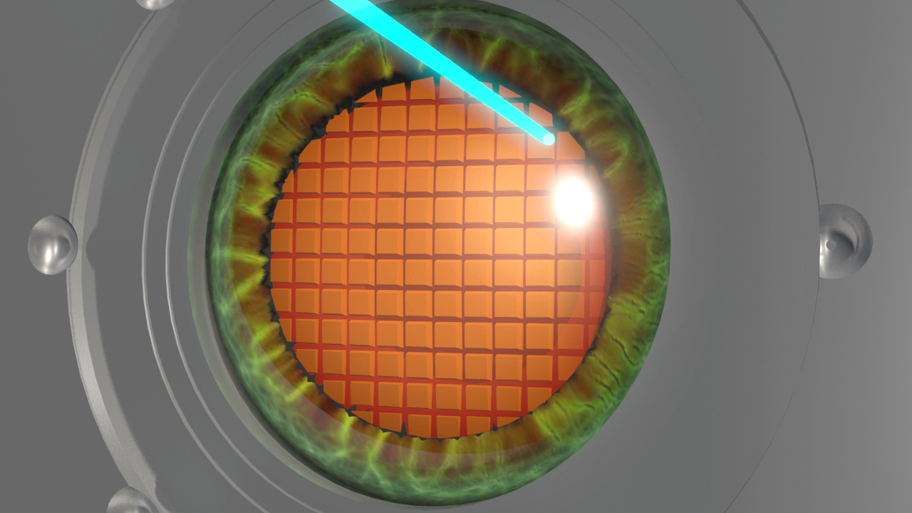 Εγχείρηση Καταρράκτη