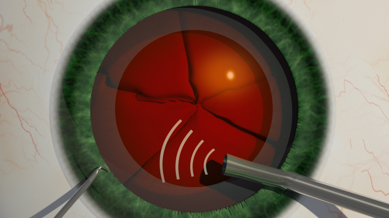 Κλασσικός Καταρράκτης