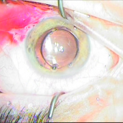 Τελικό αποτέλεσμα