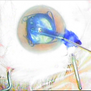 ΧΡΩΣΗ ΠΕΡΙΦΑΚΙΟΥ