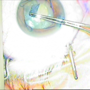 ΚΑΨΟΥΛΟΡΗΞΗ