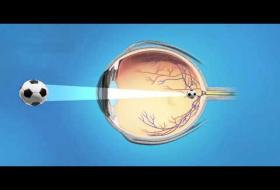 Υπερμετρωπία