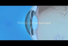 Στενή Γωνία Προσθίου Θαλάμου