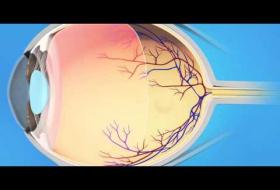 Επαμφιβληστροειδής Μεμβράνη